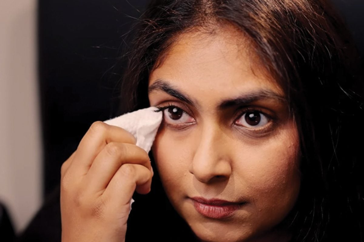 Use Eyelid Wipes Thumb Use Eyelid Wipes Thumb